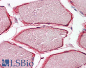 Anti-CAV3 / Caveolin 3 Antibody (N-Terminus) IHC-plus LS-B8308