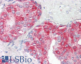 Anti-ACPP / PAP Antibody (Internal) IHC-plus LS-B8309