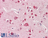 Anti-STK39 / SPAK Antibody (Internal) IHC-plus LS-B8310