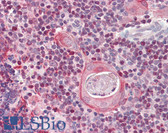 Anti-SATB1 Antibody (Internal) IHC-plus LS-B8311