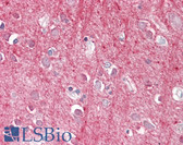 Anti-THY1 / CD90 Antibody (Internal) IHC-plus LS-B8313