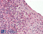 Anti-BLIMP1 / PRDM1 Antibody (Internal) IHC-plus LS-B8314