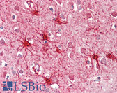 Anti-GLUD1/Glutamate Dehydrogenase Antibody (Internal) IHC-plus LS-B8318