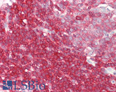 Anti-LSP1 Antibody (C-Terminus) IHC-plus LS-B8321