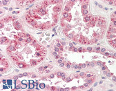 Anti-SPP1 / Osteopontin Antibody (C-Terminus, clone 1B20) IHC-plus LS-B8326