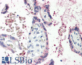 Anti-TIMP2 Antibody (aa178-193) IHC-plus LS-B8328