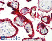 Anti-CGA / hCG Alpha Antibody (clone ME.111) IHC-plus LS-B8329
