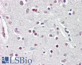 Anti-SOX3 Antibody (C-Terminus) IHC-plus LS-B8332