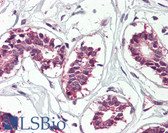 Anti-CRD-BP / ZBP1 / IGF2BP1 Antibody (Internal) IHC-plus LS-B8333