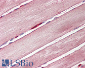 Anti-SLC2A4 / GLUT-4 Antibody (C-Terminus) IHC-plus LS-B8335