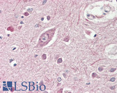 Anti-GRM2 / MGLUR2 Antibody (Internal) IHC-plus LS-B8336