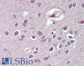 Anti-ARHGDIG / RHOGDI-3 Antibody (C-Terminus) IHC-plus LS-B8339