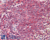 Anti-SNAP23 / SNAP-23 Antibody (Internal) IHC-plus LS-B8340