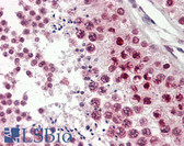 Anti-CIRP / CIRBP Antibody (aa161-172) IHC-plus LS-B8341