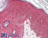Anti-PSMB4 Antibody (Internal) IHC-plus LS-B8342