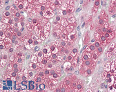 Anti-CYPOR / POR Antibody (Internal) IHC-plus LS-B8343