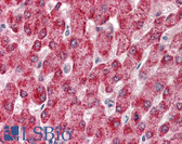 Anti-CYP2E1 Antibody (Internal) IHC-plus LS-B8344