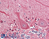 Anti-SEPT4 / Septin 4 Antibody (Internal) IHC-plus LS-B8346