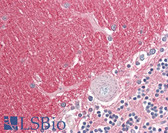 Anti-GNB3 Antibody (Internal) IHC-plus LS-B8347