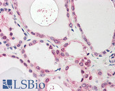 Anti-NEK7 Antibody (Internal) IHC-plus LS-B8348