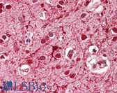 Anti-ASCL3 Antibody (Internal) IHC-plus LS-B8350