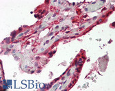 Anti-DAB2 Antibody (aa345-358) IHC-plus LS-B8351