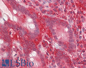 Anti-GNB2L1 / RACK1 Antibody (Internal) IHC-plus LS-B8352