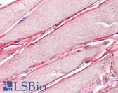 Anti-SGCD / Delta-Sarcoglycan Antibody (Internal) IHC-plus LS-B8353