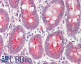 Anti-NQO1 Antibody (Internal) IHC-plus LS-B8354