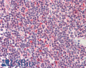 Anti-STK38 Antibody (Internal) IHC-plus LS-B8355