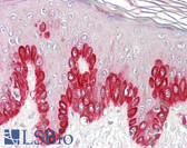 Anti-SIRT1 / Sirtuin 1 Antibody (Internal) IHC-plus LS-B8356