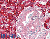 Anti-PDIA2 Antibody (Internal) IHC-plus LS-B8358