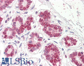 Anti-UBASH3A / CLIP4 Antibody (Internal) IHC-plus LS-B8359