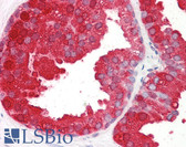 Anti-ACPP / PAP Antibody (Internal) IHC-plus LS-B8361