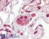 Anti-AES / Groucho Antibody (N-Terminus) IHC-plus LS-B8362