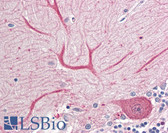 Anti-KEAP1 Antibody (N-Terminus) IHC-plus LS-B8363