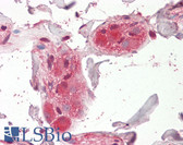 Anti-CHRNA5 Antibody (Internal) IHC-plus LS-B8364