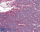 Anti-IDH3A Antibody (C-Terminus) IHC-plus LS-B8365