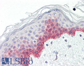 Anti-ESPL1 / Separase Antibody (aa767-816) IHC-plus LS-B8366
