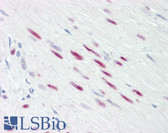 Anti-SRF / Serum Response Factor Antibody (aa71-120) IHC-plus LS-B8367
