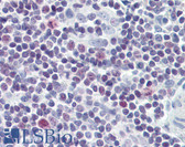 Anti-BIRC5 / Survivin Antibody (aa86-135) IHC-plus LS-B8368