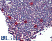 Anti-PBK / TOPK Antibody (aa1-50) IHC-plus LS-B8369