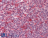 Anti-HDAC1 Antibody (aa387-436) IHC-plus LS-B8372