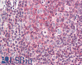 Anti-PTK2B / PYK2 Antibody (aa369-418) IHC-plus LS-B8376