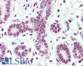 Anti-CTBP1 / CTBP Antibody (aa388-437) IHC-plus LS-B8378