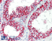 Anti-CLDN4 / Claudin 4 Antibody (aa160-209) IHC-plus LS-B8382