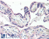 Anti-SLC2A1 / GLUT-1 Antibody (aa441-490) IHC-plus LS-B8385