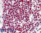 Anti-HDAC1 Antibody (aa433-482) IHC-plus LS-B8386