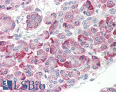 Anti-HSPH1 / HSP110 Antibody (aa791-840) IHC-plus LS-B8387