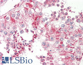 Anti-SCGB2A1 / Mammaglobin B Antibody (aa10-59) IHC-plus LS-B8390